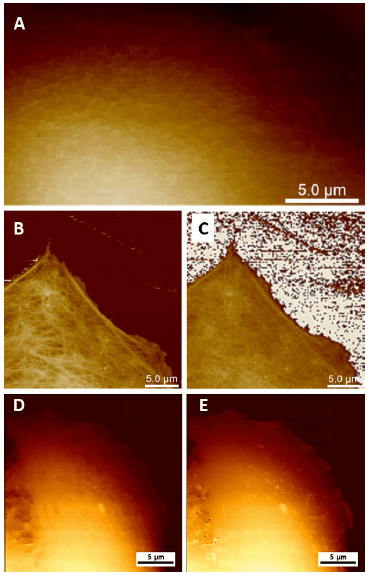 Live cell imaging with Atomic Force Microscopy