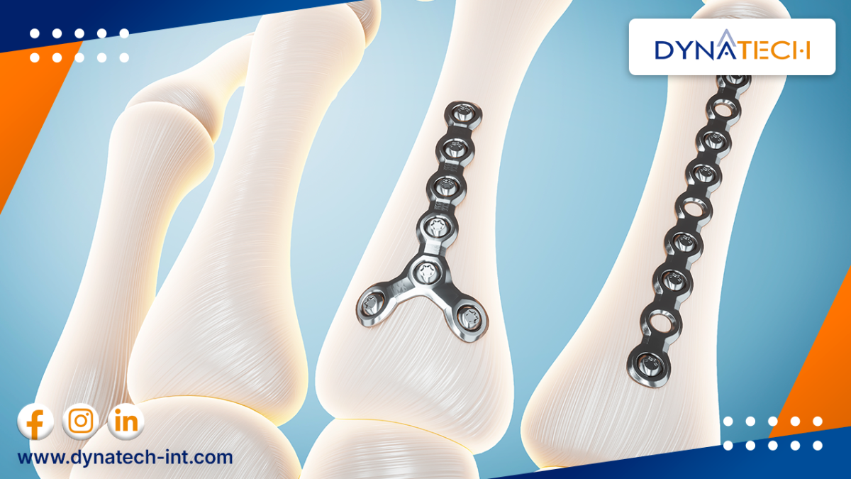 karakteristik implan tulang